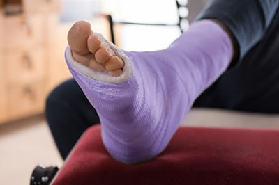 foot and ankle fractures treatment in the Plymouth County, MA: Plymouth (Kingston, Duxbury, Marshfield, Pembroke, Hanson, Halifax, Middleborough, Carver, Bridgewater, Lakeville) areas